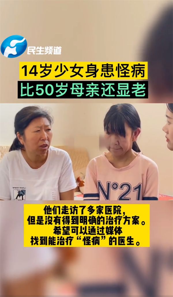 14岁少女患罕见怪病长相衰老：面容比50岁母亲还显老